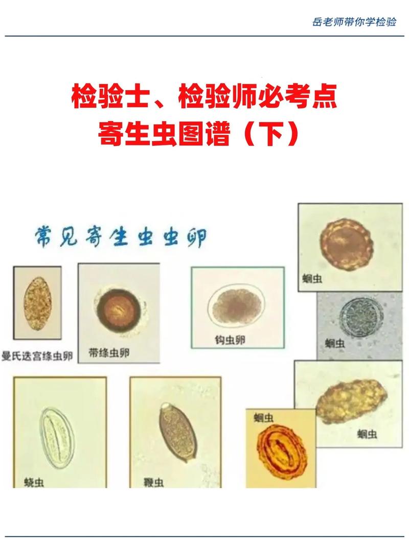 寄生虫高清完整版下载-迅雷百度云资源
