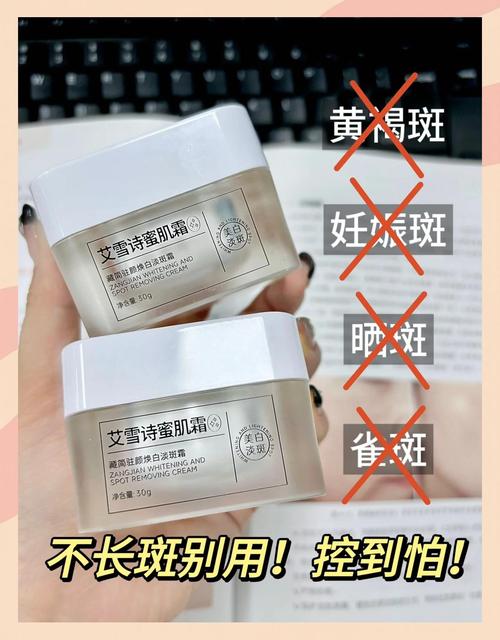 脸上长斑元凶竟是这几大习惯