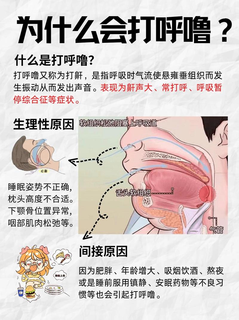 睡眠医学新探:气道塌陷与神经调控失衡揭示鼾声成因之谜