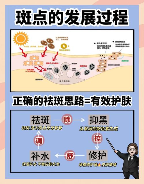 脸上长斑元凶竟是这几大习惯