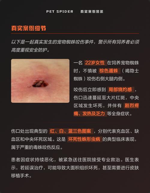 蜘蛛池对网站有伤害吗?揭秘黑帽SEO背后的风险与代价