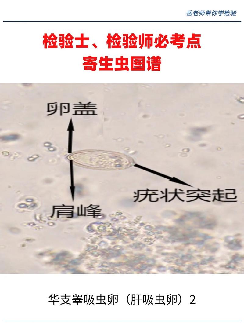 寄生虫高清完整版下载-迅雷百度云资源